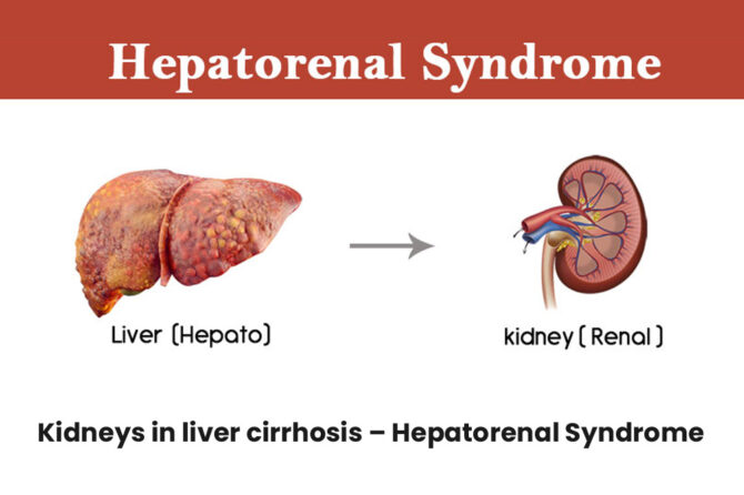 Kidneys in liver cirrhosis – Hepatorenal Syndrome – Dr. Pathik Parikh