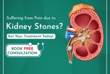 Get Laser Kidney Stone Treatment in Delhi