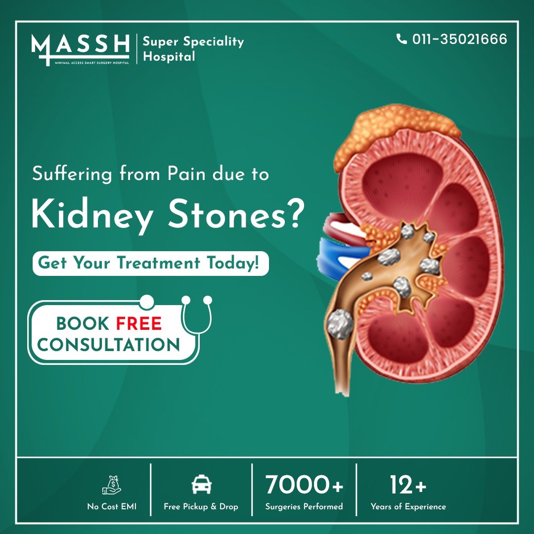 Get Laser Kidney Stone Treatment in Delhi