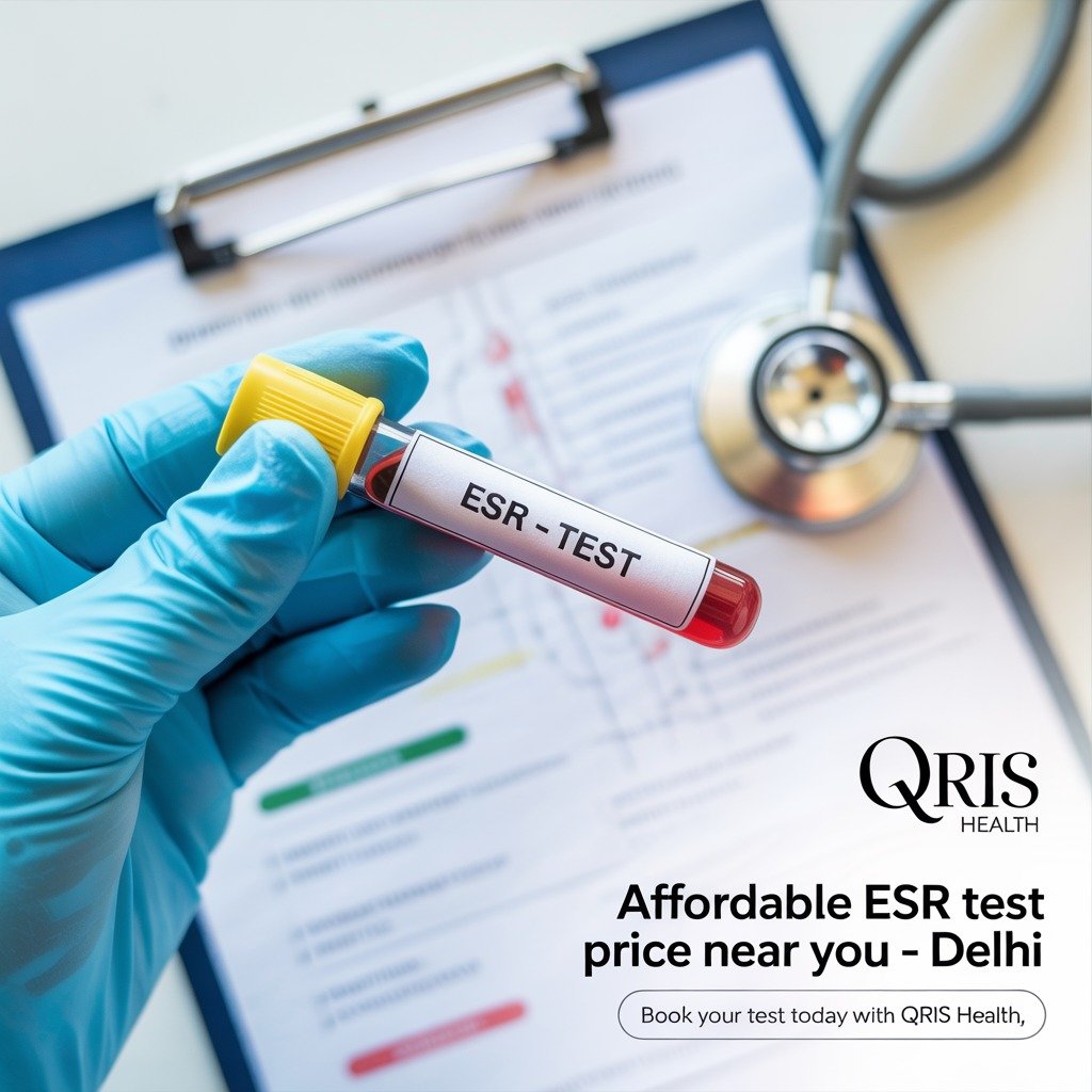 Affordable ESR Test Price Near You Delhi
