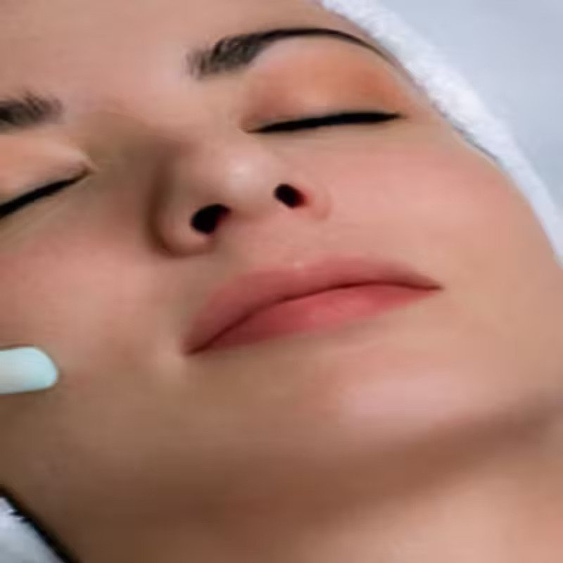 Scar Removal treatment in kochi