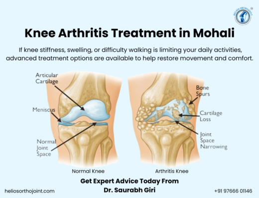 Helios orthopaedics