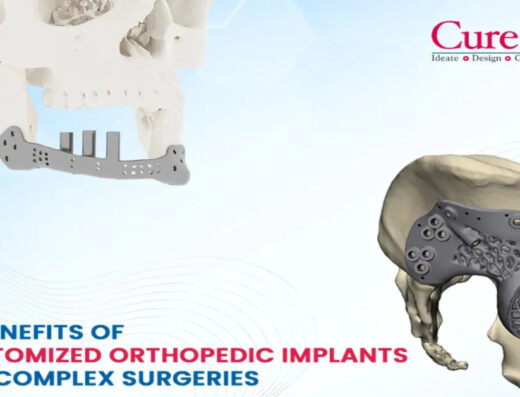 Advanced Customized Orthopedic Implants for Personalized Treatment